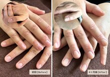 マニュキュア(Manicure)