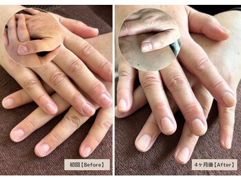 マニュキュア(Manicure)