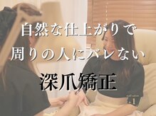 プラスワン(+1)