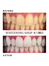 ホワイトニングショップ 本八幡店/歯科提携　ホワイトニング専門店