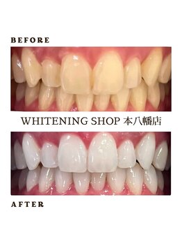 ホワイトニングショップ 本八幡店/歯科提携　ホワイトニング専門店