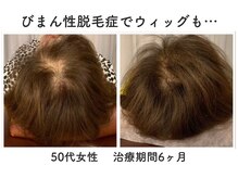 あるしあ鍼灸接骨院 木曽川院の雰囲気(ほうれい線や、頬のたるみ改善でリフトアップ!)