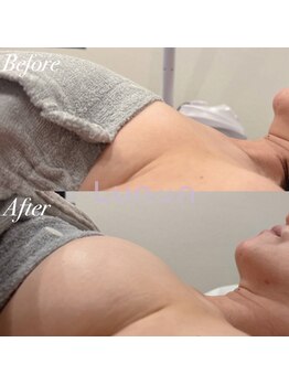 ルノン(Lunon)/【50代・ハリ＆弾力】バストケア