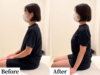 ソレア(Solea)/猫背・姿勢改善1回目