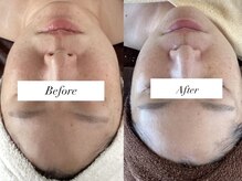 ジョーヌ(JAUNE)の雰囲気（平均ツートーンアップ◎特許取得技術で根本からお肌を立て直し！）