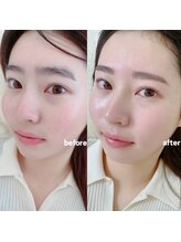 アイル(I’LL)/setで垢抜けられるクーポン☆