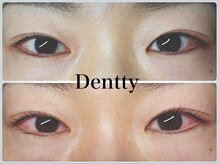 ネイルサロン デンティ(Dentty)/まつげパーマ