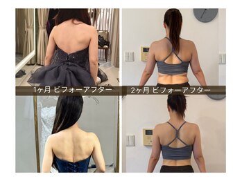 リベア(REBEA)の写真/短期集中！1台4役ラジオ波×吸上げ×LED×ほぐしで脂肪を温めケアし理想へ◎