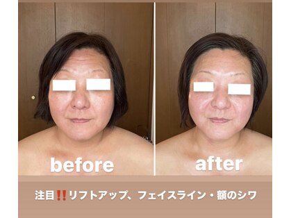 アヴニール(avenir)の写真