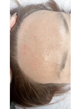 ルルゴ(LULUGO)/おでこワックス