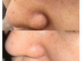 ル シーニュ/綺麗を保つ