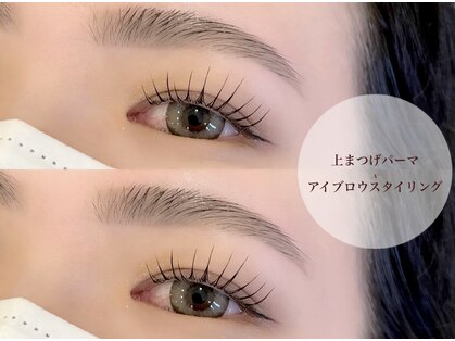 アウレル(AUREL)の写真