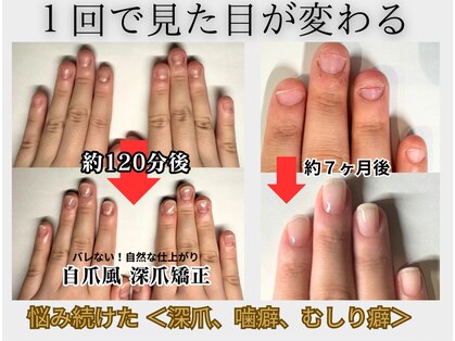 クウ(KUU)の写真