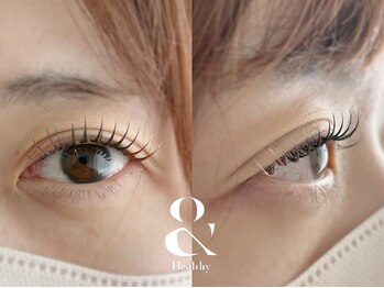 ムニ(muni)/&healthy【アンドヘルシー】