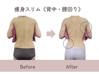 ティファニー/痩身スリム