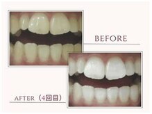 ラディアンス(Radiance+)