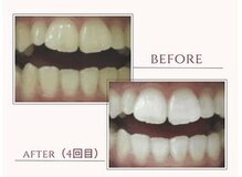 ラディアンス(Radiance+)