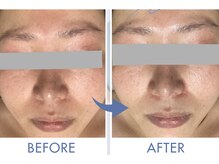 マカナ(Makana)の雰囲気（クリニック導入＊お肌のトラブルを内側から肌質改善します！）