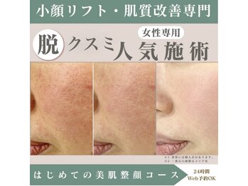 整顔院 自由が丘店の写真/毛穴の広がりやくすみにサヨナラ!小顔リフトでハリ感アップ◎自信あふれる笑顔へ☆