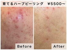 キュアルーム(CURE ROOM)