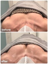 美人バスト 赤羽店/【バストアップ症例】