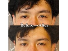 メンズ脱毛 メンズエステ エイト(8)の雰囲気（眉毛スタイリングの症例多数あり☆）