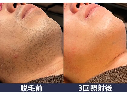 メンズアルファの写真