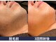 メンズアルファの写真
