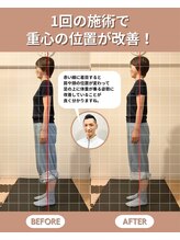 スペックフィジカルコンディショニング(SPECフィジカルコンディショニング)/50代女性/姿勢ビフォーアフター