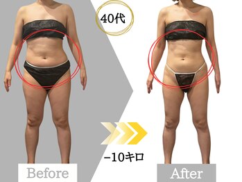 ジャパ(JAPA)/人気No.1!ハイパーナイフ痩身