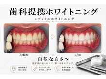 プリマ 前橋店