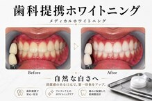 プリマ 前橋店
