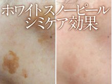 スイ 昭島店(Sui)の雰囲気(夏に向けて輝く素肌へ!1回で首元までトーンUPする白雪肌エステ)
