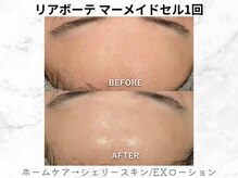 リライン(ReLine)/【マーメイドセル1回】