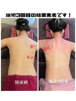 フェリーチェ(felice)/セル分解ビフォーアフター