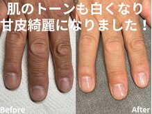 大人ネイル/ハンドケア