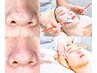 【ぽっかり毛穴の開きにお悩みの方】へ短期集中毛穴改善プログラム 初回体験