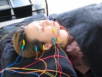 リュクス 恵比寿 代官山(LUXE)/施術風景【美容鍼/代官山/東京】