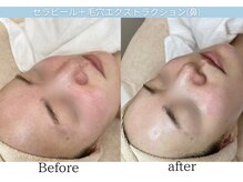 サロン ド ソワン(salon de soin)の雰囲気（【NEW】セラピールで透明感◎）