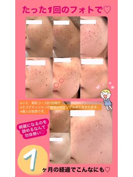 パタティパタタ(PatatiPatata)/たった一回のフォトで!