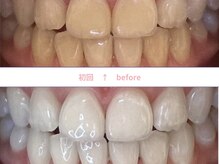 ビナリ(B,nari)の雰囲気（極上な白さへ導きます☆医療提携/失敗しない/短時間/効果抜群）