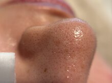 リセットプラス(Reset+)/お鼻の産毛目立っていませんか？