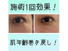 パーソナル ユニ(uni)