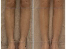 ダリアビューティーアンドピラティス 麻布十番(Daria beauty & pilates)/機械で脚のだる重い疲れを[疲労]