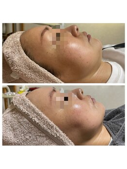 レミリー(Lemiry)/レモンボトル