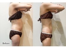 アネル 宮古島店(anel)/