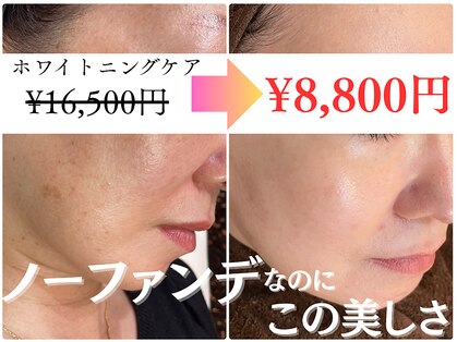 ラピュール(RaPur)の写真