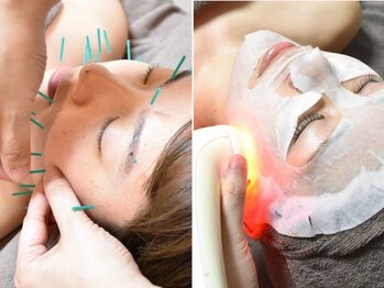 ドリームスタイル 川崎駅前(Dream Style)の写真/毛穴/肌トラブルに応えるフェイシャルエステ♪肌状態&お悩みに合わせて選べる美容鍼/ヒト幹細胞/プラセンタ