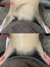 ミース 越谷店/うなじ矯正●Before、After