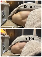 フィール(feel)/整体＋リンパ　Before & After